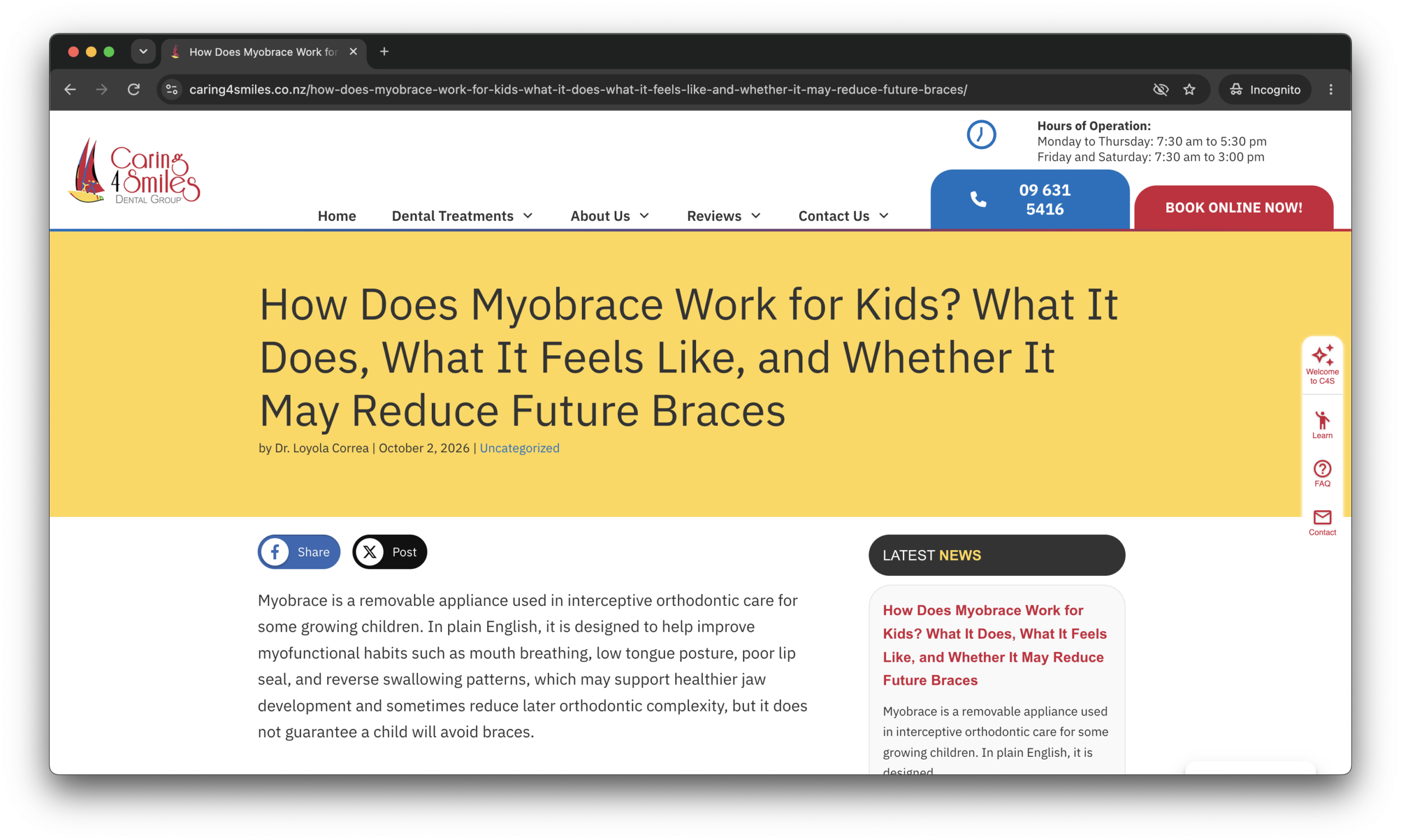 An article about how Myobrace works for kids on the Caring 4 Smiles blog